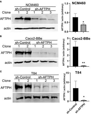 Aftiphilin Regulation of Myosin Light Chain Kinase Activity Promotes Actin Dynamics and Intestinal Epithelial Barrier Function